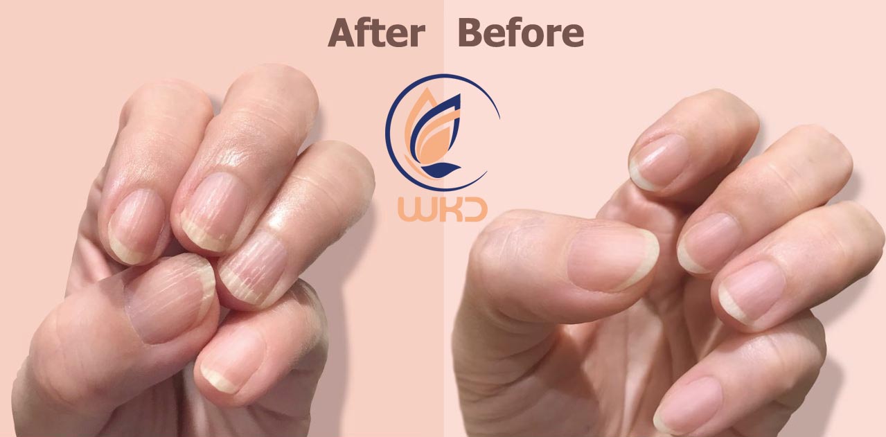 قبل و بعد روغن تقویت ناخن و کوتیکول WKD